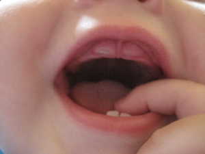 baby-teeth